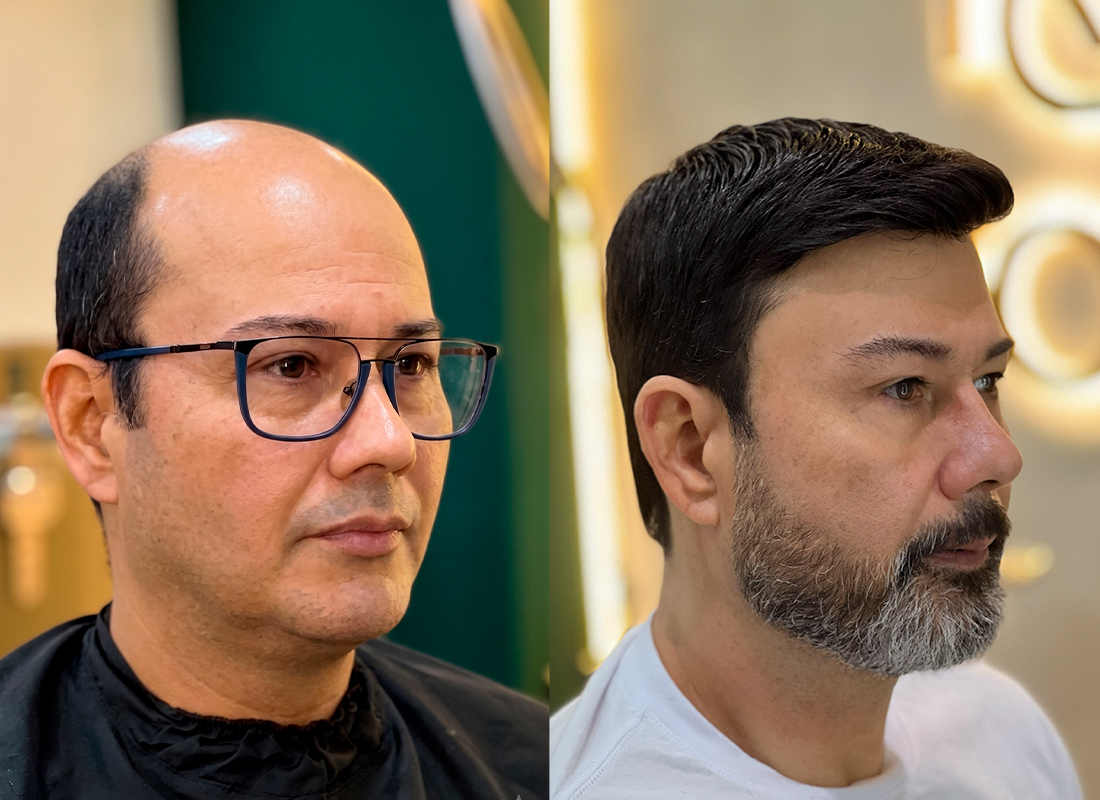 Antes e depois do cliente 1