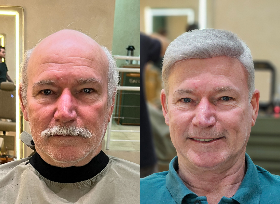 Antes e depois do cliente 2